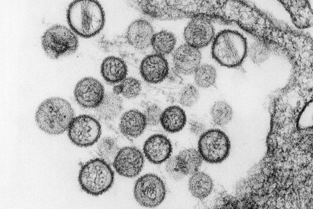 Michigan woman sickened with rare hantavirus after cleaning up after rodents – New York Post