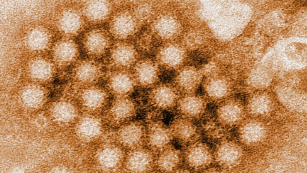 Previously Common Diseases Are Bouncing Back After a Covid Hiatus – Gizmodo