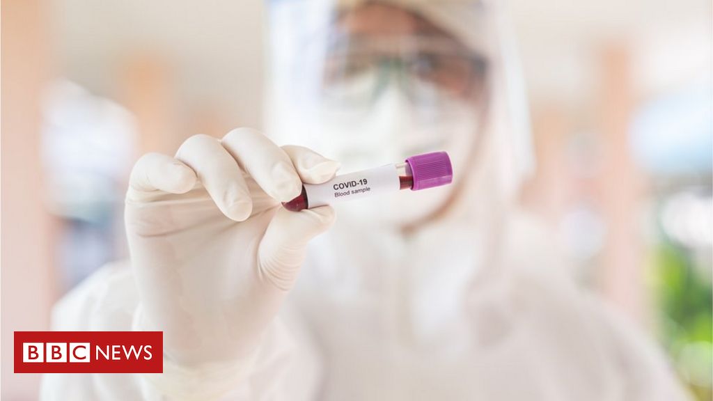 Covid: Is there a limit to how much worse variants can get? – BBC News
