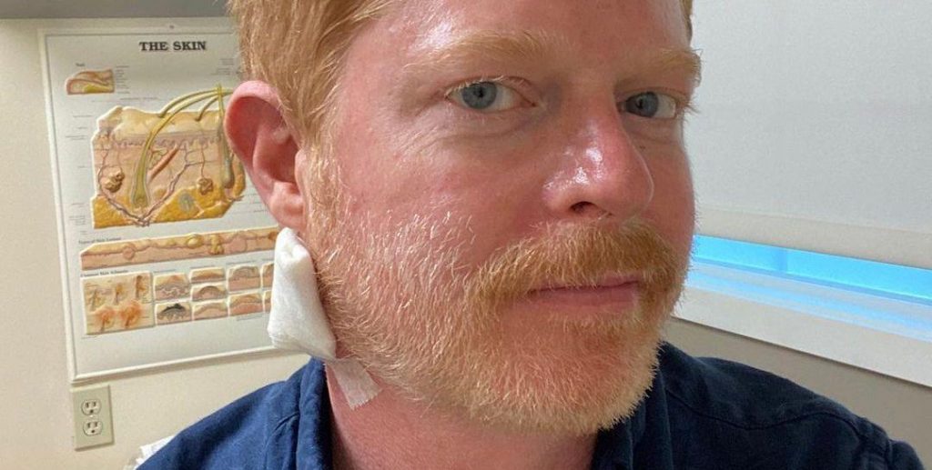 ‘Modern Family’ Star Jesse Tyler Ferguson Reveals He Had a Skin Cancer Scare on Instagram – Yahoo Lifestyle