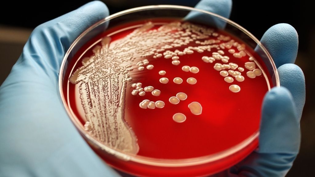 Scientists found a new way to kill drug-resistant superbugs – Livescience.com