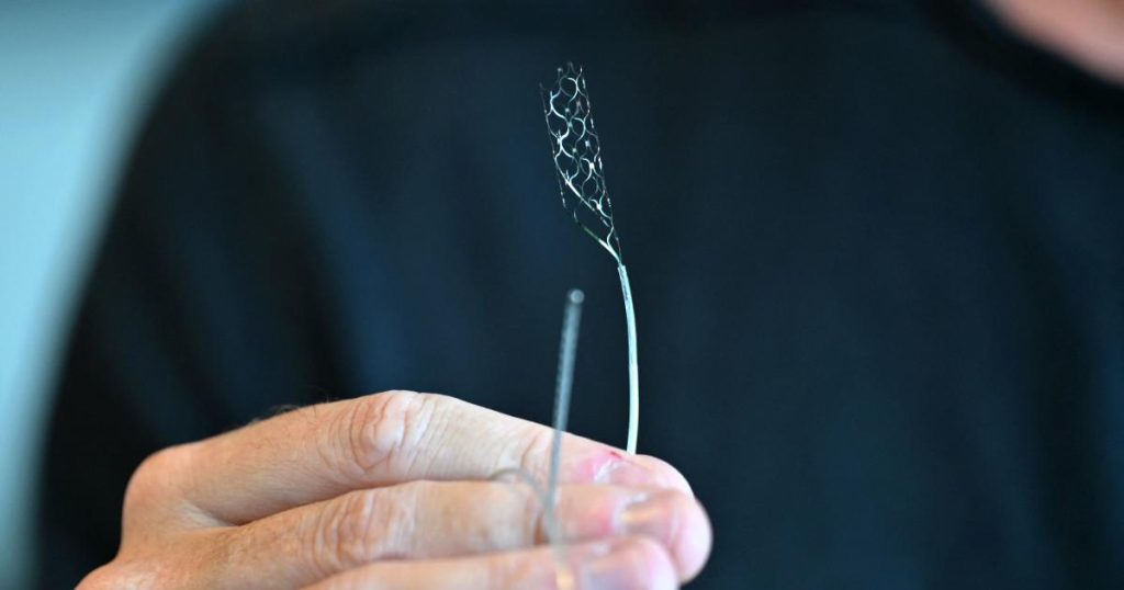 Synchrons BCI implants may help paralyzed patients reconnect with the world